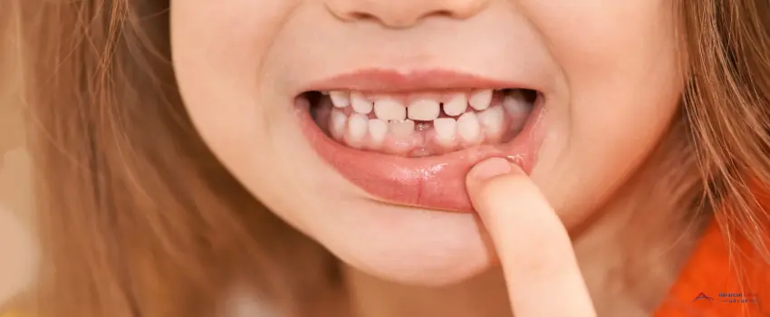 ADG-Baby teeth play important roles in your child's growth and development