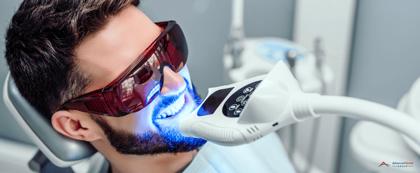 ADG-Dentist starting teeth whitening procedure with young man