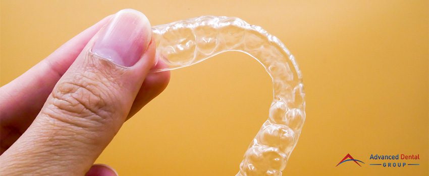 Is Invisalign the Right Treatment for Me