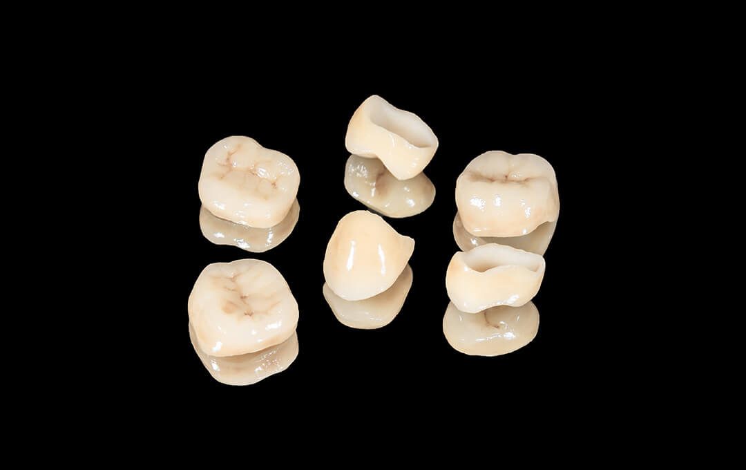ADG Advantage of Dental Crowns
