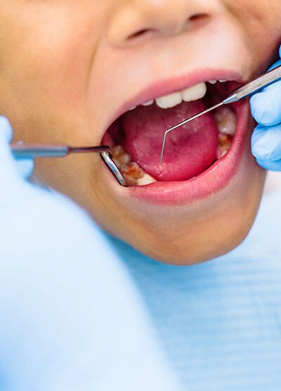 ADG Bad Dental Habits