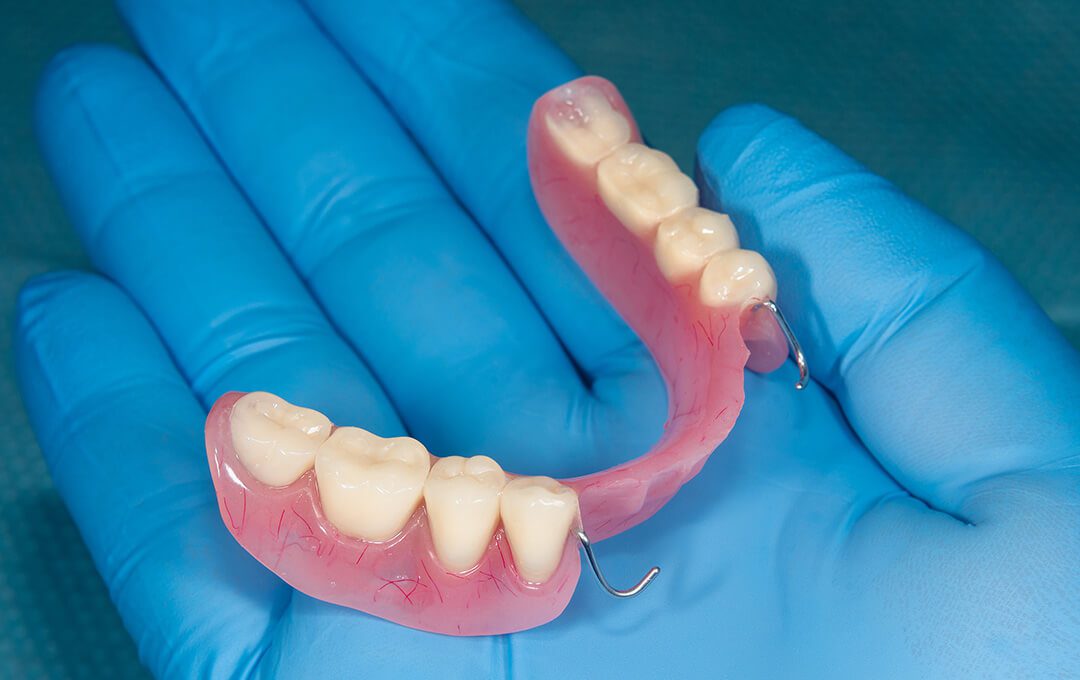 ADG Benefit of Dentures