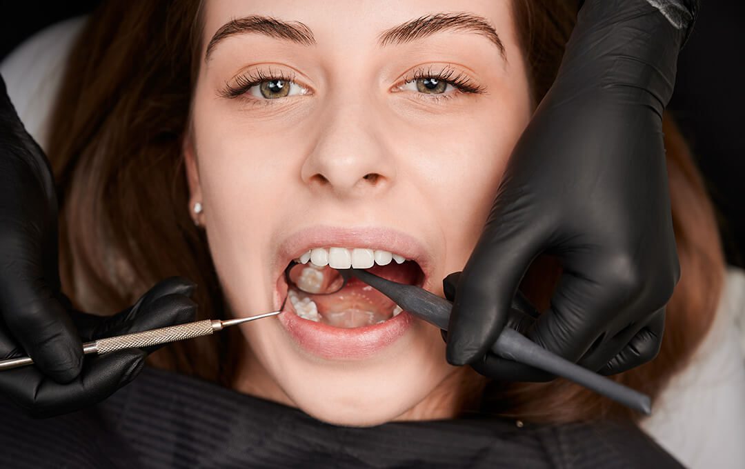 ADG Colorado Tooth Decay Examination