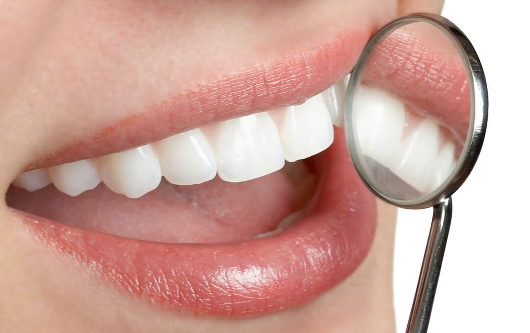 ADG Cosmetic Teeth Whitening