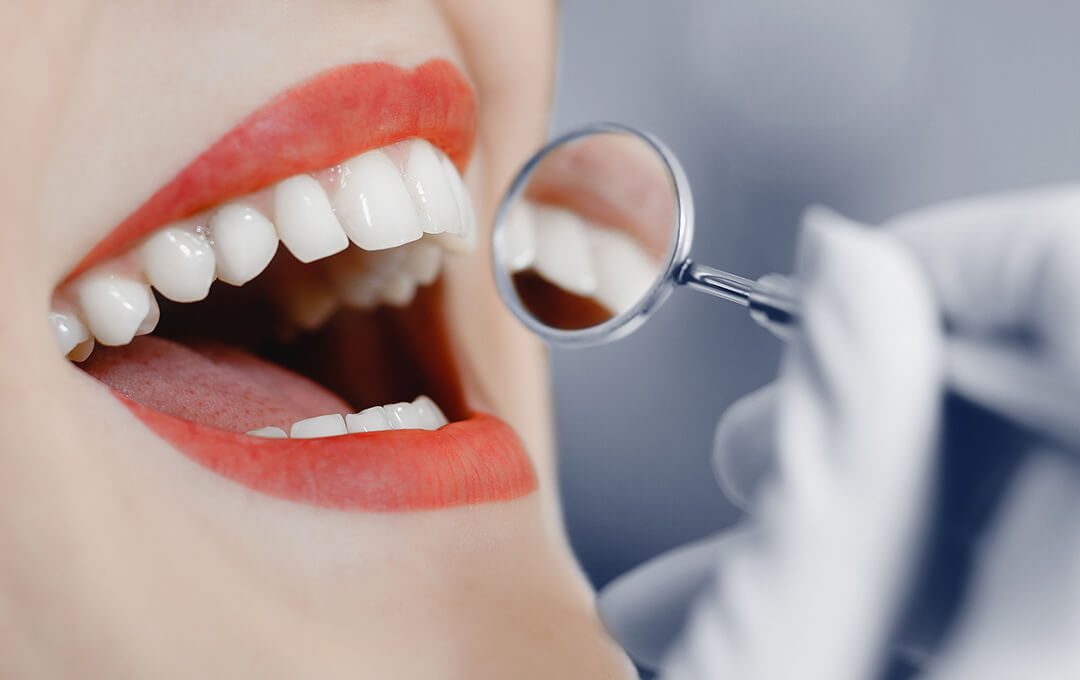 ADG Maintain Perfect Teeth