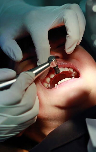 Regular Dental Visit Habits