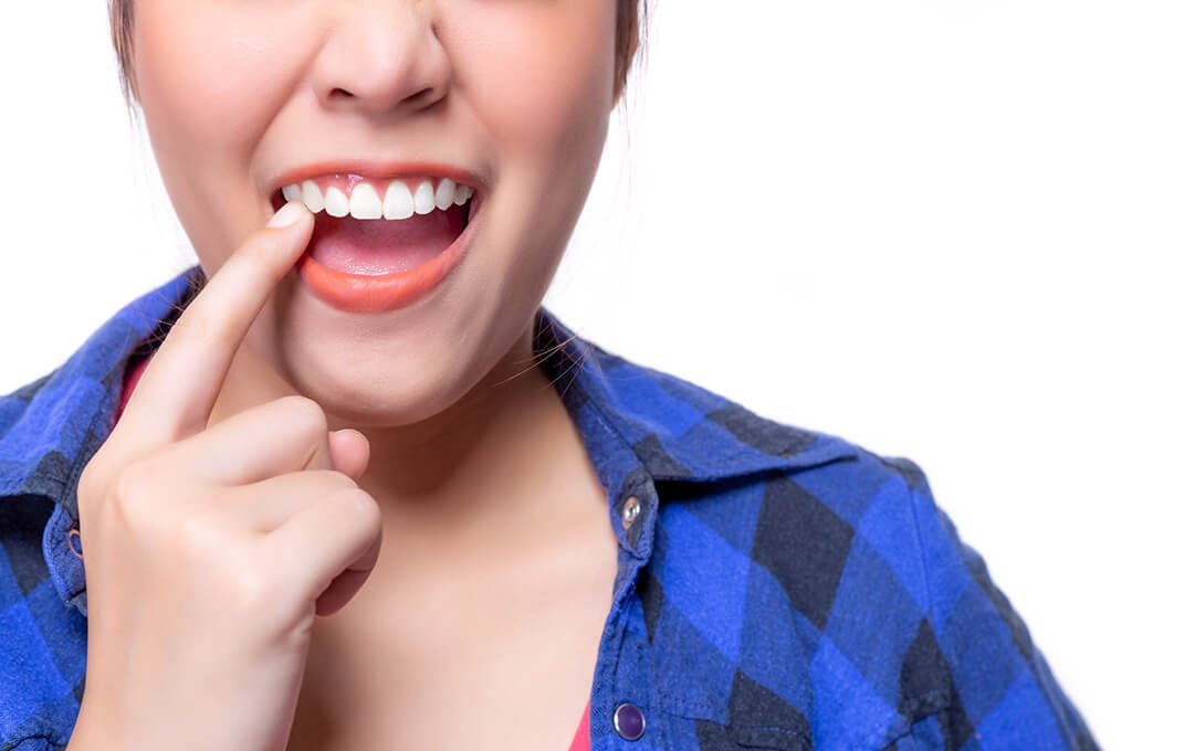 ADG Stop Bad Oral Habits