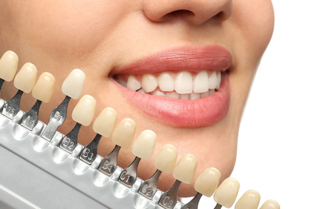 ADG What is Cosmetic Dentistry
