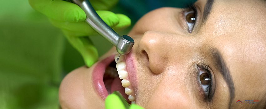 drill central incisor preparing tooth for sealant placement