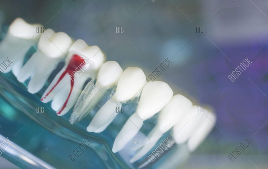 ADG Dentist Tools